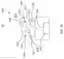 Fig. 13 - CATHETER INFLATABLE CUFF PRESSURE-SENSING DEVICES
