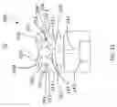 Fig. 14 - CATHETER INFLATABLE CUFF PRESSURE-SENSING DEVICES