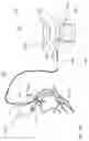 Fig. 18 - CATHETER INFLATABLE CUFF PRESSURE-SENSING DEVICES