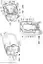 Fig. 19 - CATHETER INFLATABLE CUFF PRESSURE-SENSING DEVICES