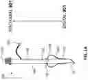 Fig. 02 - VENTILATION TUBES WITH INFLATABLE CUFFS