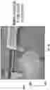 Fig. 17 - VENTILATION TUBES WITH INFLATABLE CUFFS
