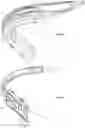Fig. 02 - AN AIRWAY MANAGEMENT DEVICE AND METHODS OF MANUFACTURING AN OBJECT