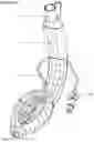 Fig. 16 - AN AIRWAY MANAGEMENT DEVICE AND METHODS OF MANUFACTURING AN OBJECT