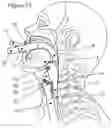 Fig. 25 - AN AIRWAY MANAGEMENT DEVICE AND METHODS OF MANUFACTURING AN OBJECT