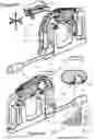 Fig. 31 - AN AIRWAY MANAGEMENT DEVICE AND METHODS OF MANUFACTURING AN OBJECT