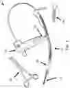 Fig. 03 - Endotracheal intubation assistance system