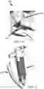 Fig. 08 - Endotracheal intubation assistance system