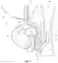 Fig. 11 - Fluid Mixing Apparatus Such as a Ventilator