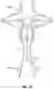 Fig. 21 - Fluid Mixing Apparatus Such as a Ventilator