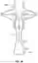 Fig. 23 - Fluid Mixing Apparatus Such as a Ventilator