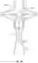 Fig. 26 - Fluid Mixing Apparatus Such as a Ventilator