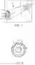 Fig. 05 - System and method for low-profile occlusion balloon catheter