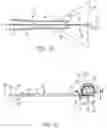 Fig. 10 - System and method for low-profile occlusion balloon catheter