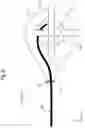 Fig. 10 - DRUG SOLUTION INJECTION DEVICE