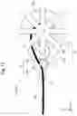 Fig. 12 - DRUG SOLUTION INJECTION DEVICE