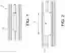 Fig. 02 - BALLOON CATHETER WITH ENHANCED LOCATABILITY