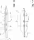 Fig. 11 - BALLOON CATHETER WITH ENHANCED LOCATABILITY