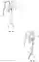 Fig. 02 - Microfabricated catheter having an intermediate preferred bending section
