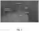 Fig. 04 - MICROCATHETER FOR THERAPEUTIC AND/OR DIAGNOSTIC INTERVENTIONS IN THE SUBARACHNOID SPACE