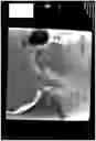 Fig. 11 - MICROCATHETER FOR THERAPEUTIC AND/OR DIAGNOSTIC INTERVENTIONS IN THE SUBARACHNOID SPACE