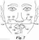 Fig. 05 - TUBE SECUREMENT DEVICE WITH ADJUSTABLE SIZE