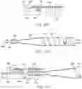 Fig. 29 - Guidewire assembly