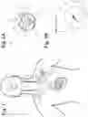 Fig. 02 - IMPLANTABLE NEUROSTIMULATOR-IMPLEMENTED METHOD FOR MANAGING BRADYCARDIA THROUGH VAGUS NERVE STIMULATION