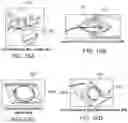 Fig. 18 - STIMULATION APPARATUS