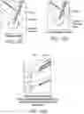 Fig. 19 - STIMULATION APPARATUS