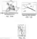 Fig. 20 - STIMULATION APPARATUS