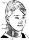 Fig. 08 - Non-invasive nerve stimulation with mobile device