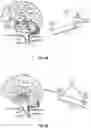 Fig. 07 - SYSTEMS AND METHODS FOR CRANIOCERVICAL AND AURICULAR NEUROMODULATION