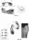 Fig. 12 - SYSTEMS AND METHODS FOR CRANIOCERVICAL AND AURICULAR NEUROMODULATION