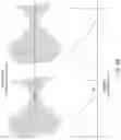 Fig. 09 - Neuromodulation using modulated pulse train