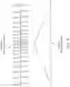 Fig. 11 - Neuromodulation using modulated pulse train