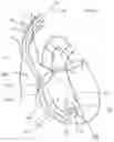 Fig. 07 - CURLED SHAFT TEMPORARY PACING LEAD