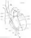 Fig. 28 - CURLED SHAFT TEMPORARY PACING LEAD