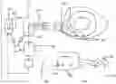 Fig. 43 - CURLED SHAFT TEMPORARY PACING LEAD