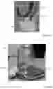 Fig. 100 - Methods for treating disorders and for stimulating stem cells by administering light therapy