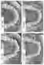 Fig. 113 - Methods for treating disorders and for stimulating stem cells by administering light therapy