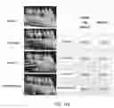 Fig. 115 - Methods for treating disorders and for stimulating stem cells by administering light therapy