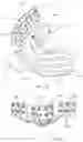 Fig. 93 - Methods for treating disorders and for stimulating stem cells by administering light therapy