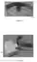 Fig. 98 - Methods for treating disorders and for stimulating stem cells by administering light therapy