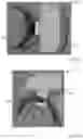 Fig. 99 - Methods for treating disorders and for stimulating stem cells by administering light therapy