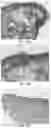 Fig. 13 - Device for photo-therapy and use thereof