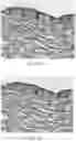 Fig. 14 - Device for photo-therapy and use thereof