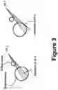 Fig. 04 - METHOD TO OPTIMALLY SPLITTING ARCS IN MODULATED ARC THERAPY (MAT) PLANS