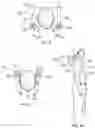 Fig. 06 - PERSONAL VENTILATION DEVICE AND METHOD FOR DELIVERING SANITIZED AIR TO PERSONAL BREATHING SPACE