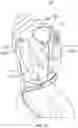 Fig. 07 - PERSONAL VENTILATION DEVICE AND METHOD FOR DELIVERING SANITIZED AIR TO PERSONAL BREATHING SPACE